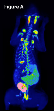 Figure 1 - Dog Lymphoma x-ray before